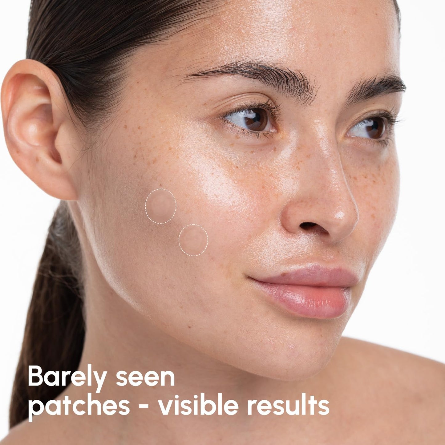 Invisible Pimple Patches